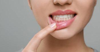 Стоматолог перечислил заболевания, сопровождающиеся сухостью во рту